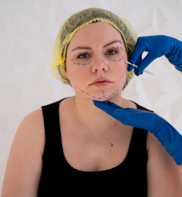 Dermato surgery