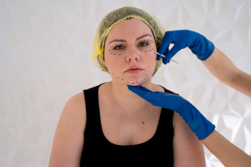 Dermato surgery
