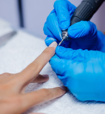 Nail Surgery