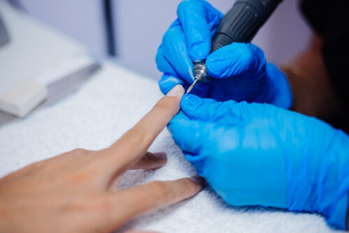 Nail Surgery