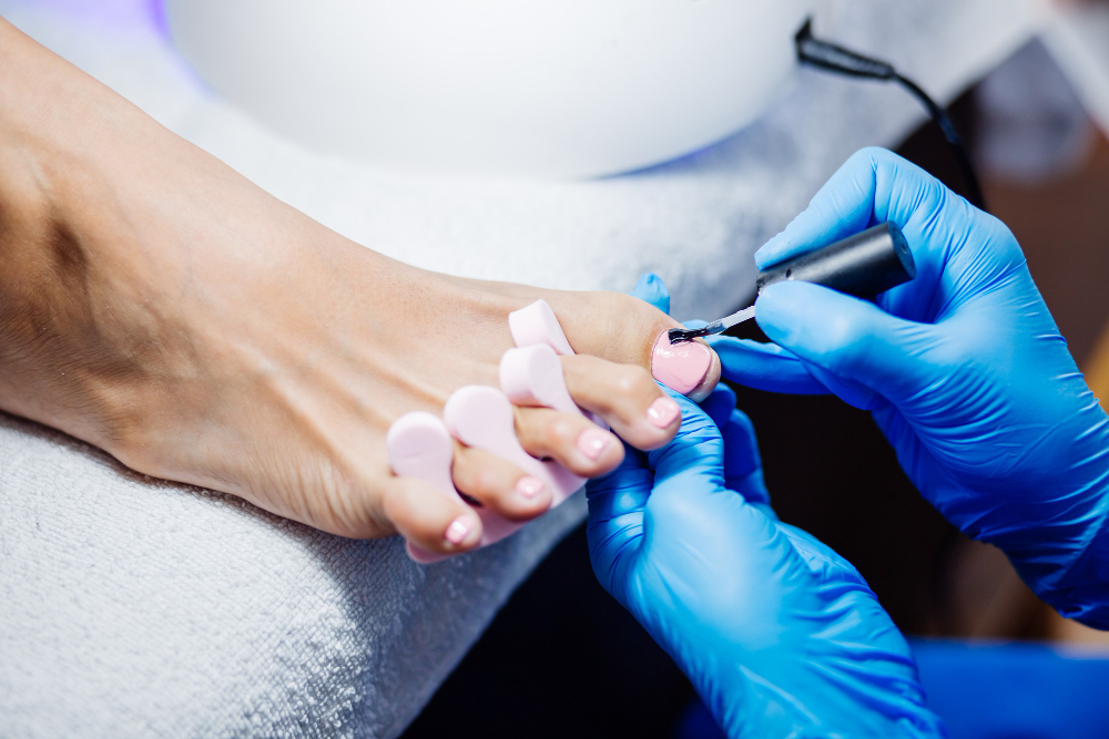 Nail surgery 4